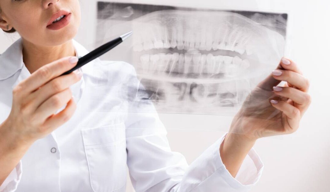 Everything You Need to Know About Wisdom Teeth