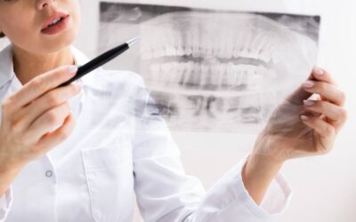 Everything You Need to Know About Wisdom Teeth