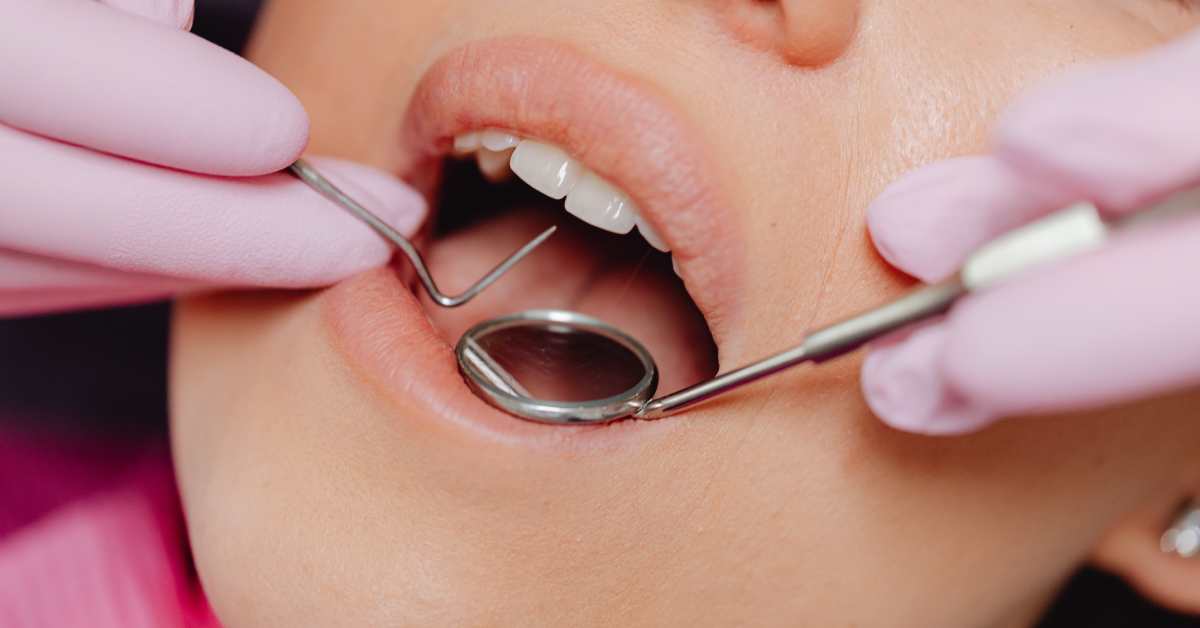Dental Problems '5 Common Invisalign Mistakes’ blog by Esthetique Dental